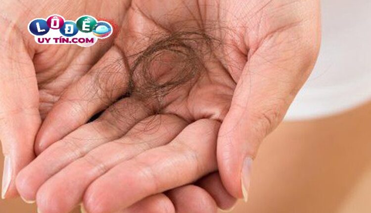 Nằm mơ thấy rụng tóc đánh số gì? Giấc mơ này là điềm tốt hay vận hạn? 3 Nằm mơ thấy rụng tóc đánh số gì 1
