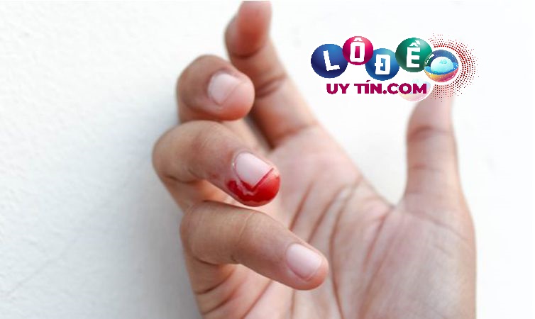 Mơ bị chặt ngón tay đánh con gì? Giải mã giấc mơ 3 Mơ bị chặt ngón tay đánh con gì 1