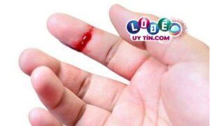Phân tích ý nghĩa xung quanh giấc mơ thấy đứt tay chảy máu