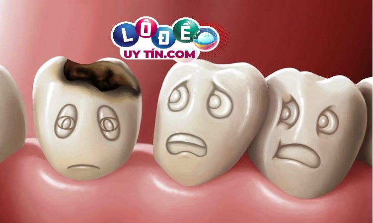 Nằm mơ thấy bị mẻ răng là điềm gì? Đánh số nào 2
