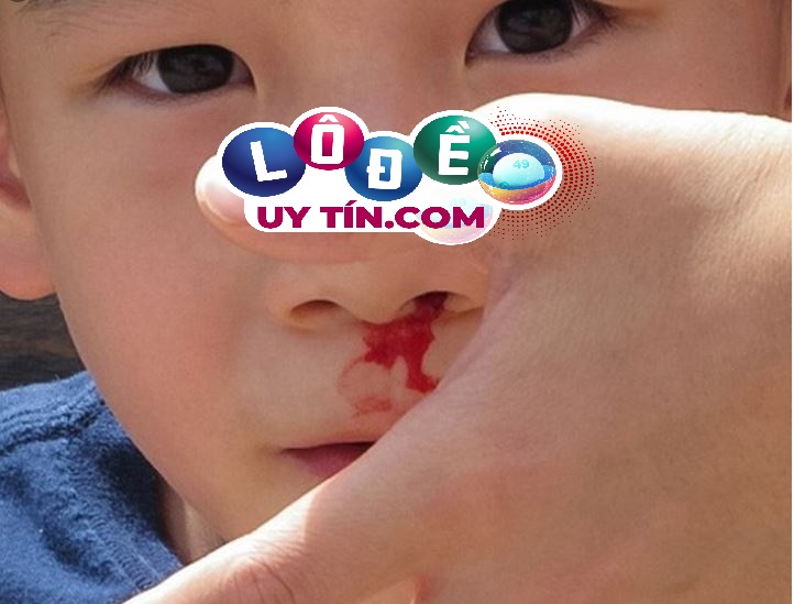 Mơ thấy chảy máu mũi, máu cam là điềm gì, đánh con gì? 1 Mơ thấy chảy máu mũi, máu cam là điềm gì, đánh con gì?