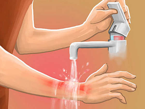 Nằm mơ thấy bị bỏng đánh lô như thế nào cho hợp lý? 2 mơ bị bỏng nước sôi