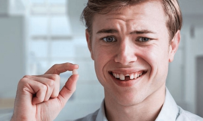 Mơ thấy rụng răng, rụng một chiếc răng, rụng cả hàm răng đánh số đề con nào? 3 Mơ thấy rụng răng, rụng một chiếc răng, rụng cả hàm răng đánh số đề con nào?